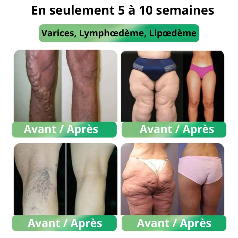 Capsules Minceur GLP-1 Naturelles